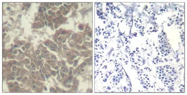 Anti-JAK2 antibody used in IHC (Paraffin sections) (IHC-P). GTX50657