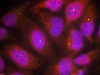 Anti-Cyclin B1 antibody used in Immunocytochemistry/ Immunofluorescence (ICC/IF). GTX50663