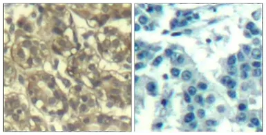 Anti-Cyclin B1 antibody used in IHC (Paraffin sections) (IHC-P). GTX50663