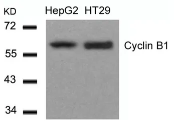 Anti-Cyclin B1 antibody used in Western Blot (WB). GTX50663