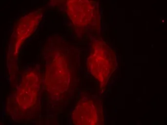 Anti-CDK6 antibody used in Immunocytochemistry/ Immunofluorescence (ICC/IF). GTX50664