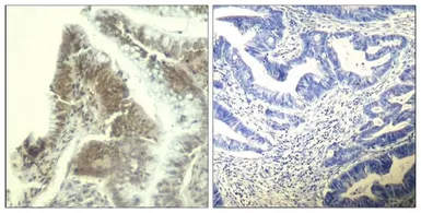 Anti-CDK6 antibody used in IHC (Paraffin sections) (IHC-P). GTX50664