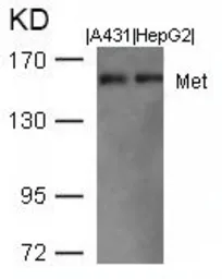 Anti-c-Met antibody used in Western Blot (WB). GTX50668