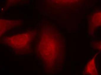 Anti-MDM2 antibody used in Immunocytochemistry/ Immunofluorescence (ICC/IF). GTX50670