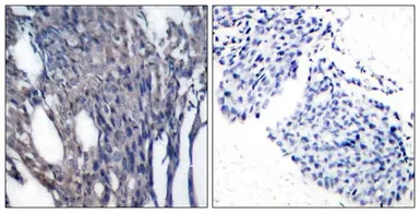 Anti-IKB alpha (phospho Tyr42) antibody used in IHC (Paraffin sections) (IHC-P). GTX50681