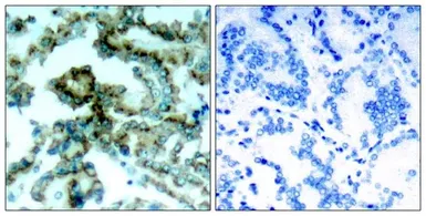 Anti-PKC beta 2 (phospho Thr641) antibody used in IHC (Paraffin sections) (IHC-P). GTX50682