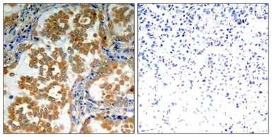 Anti-PKC zeta antibody used in IHC (Paraffin sections) (IHC-P). GTX50684