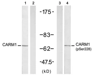 Anti-CARM1 antibody used in Western Blot (WB). GTX50685