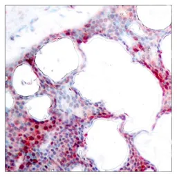 Anti-ATF2 (phospho Ser62) antibody used in IHC (Paraffin sections) (IHC-P). GTX50686
