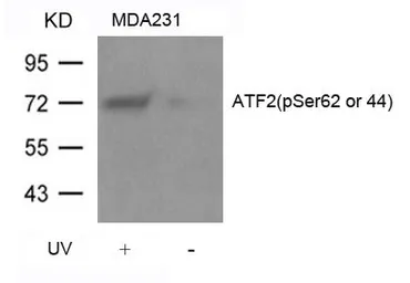 Anti-ATF2 (phospho Ser62) antibody used in Western Blot (WB). GTX50686