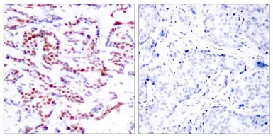 Anti-ATF2 (phospho Ser112) antibody used in IHC (Paraffin sections) (IHC-P). GTX50687