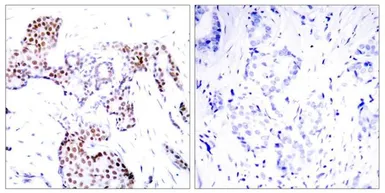 Anti-ELK1 (phospho Ser389) antibody used in IHC (Paraffin sections) (IHC-P). GTX50688