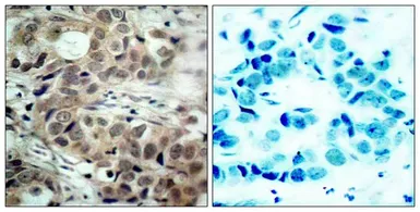 Anti-CDC25C (phospho Ser216) antibody used in IHC (Paraffin sections) (IHC-P). GTX50689