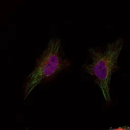Anti-BRCA1 antibody used in Immunocytochemistry/ Immunofluorescence (ICC/IF). GTX50692