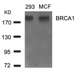 Anti-BRCA1 antibody used in Western Blot (WB). GTX50692