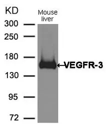 Anti-VEGF Receptor 3 antibody used in Western Blot (WB). GTX50694