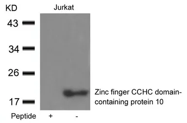 Anti-ZCCHC10 antibody used in Western Blot (WB). GTX50695