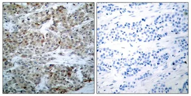 Anti-Bad (phospho Ser112) antibody used in IHC (Paraffin sections) (IHC-P). GTX50702