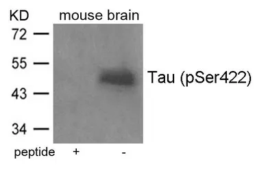 Anti-Tau (phospho Ser422) antibody used in Western Blot (WB). GTX50703