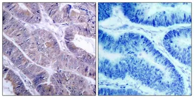 Anti-AMPK alpha 1 antibody used in IHC (Paraffin sections) (IHC-P). GTX50705