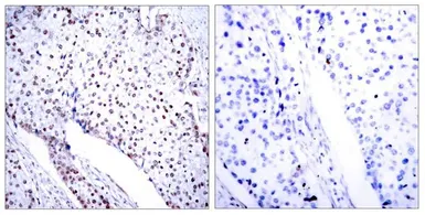 Anti-STAT3 antibody used in IHC (Paraffin sections) (IHC-P). GTX50709