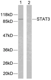 Anti-STAT3 antibody used in Western Blot (WB). GTX50709