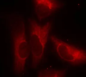 Anti-14-3-3 zeta (phospho Ser58) antibody used in Immunocytochemistry/ Immunofluorescence (ICC/IF). GTX50712