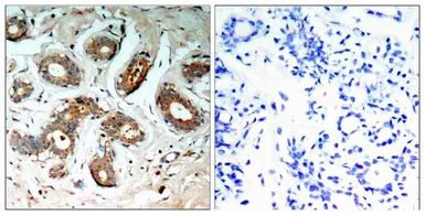 Anti-14-3-3 zeta (phospho Ser58) antibody used in IHC (Paraffin sections) (IHC-P). GTX50712