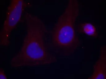 Anti-PYK2 (phospho Tyr402) antibody used in Immunocytochemistry/ Immunofluorescence (ICC/IF). GTX50713