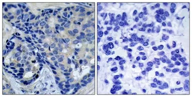Anti-PYK2 (phospho Tyr402) antibody used in IHC (Paraffin sections) (IHC-P). GTX50713