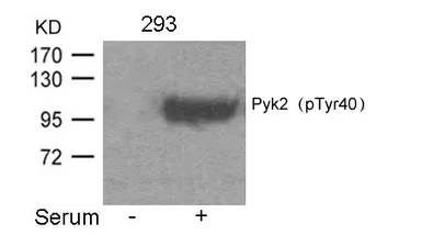 Anti-PYK2 (phospho Tyr402) antibody used in Western Blot (WB). GTX50713