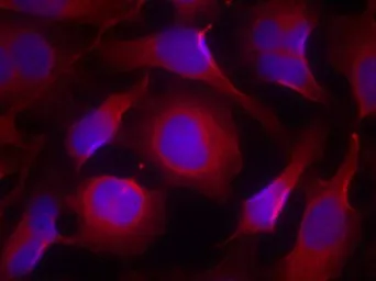 Anti-PYK2 antibody used in Immunocytochemistry/ Immunofluorescence (ICC/IF). GTX50715