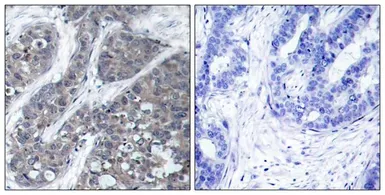 Anti-PYK2 antibody used in IHC (Paraffin sections) (IHC-P). GTX50715