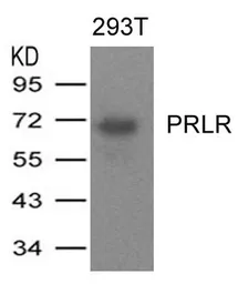 Anti-Prolactin Receptor antibody used in Western Blot (WB). GTX50723