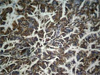 Anti-beta Catenin (phospho Tyr333) antibody used in IHC (Paraffin sections) (IHC-P). GTX50727