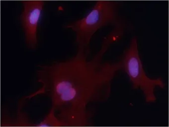 Anti-PKM1 antibody used in Immunocytochemistry/ Immunofluorescence (ICC/IF). GTX50734