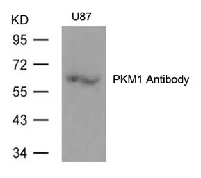 Anti-PKM1 antibody used in Western Blot (WB). GTX50734