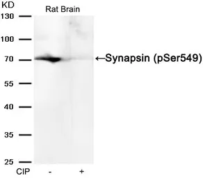 Anti-Synapsin I (phospho Ser549) antibody used in Western Blot (WB). GTX50750