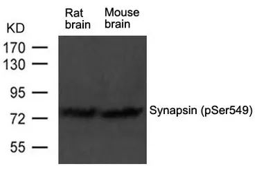 Anti-Synapsin I (phospho Ser549) antibody used in Western Blot (WB). GTX50750
