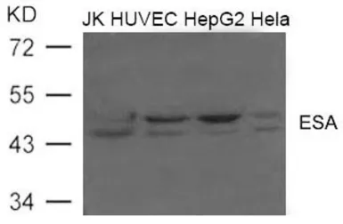 Anti-Flotillin 2 antibody used in Western Blot (WB). GTX50764