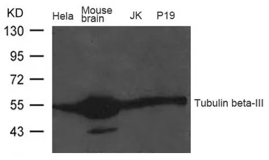Anti-beta Tubulin 3/ Tuj1 antibody used in Western Blot (WB). GTX50789