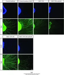 Anti-beta Tubulin 3/ Tuj1 antibody used in IHC (Frozen sections) (IHC-Fr). GTX50789