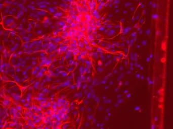 Anti-GFAP antibody used in IHC (Paraffin sections) (IHC-P). GTX50797