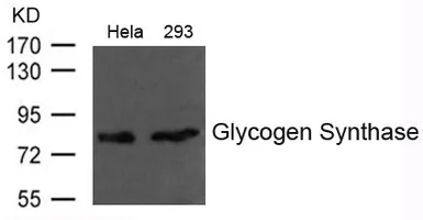 Anti-Glycogen Synthase antibody used in Western Blot (WB). GTX50798