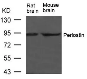 Anti-Periostin antibody used in Western Blot (WB). GTX50811