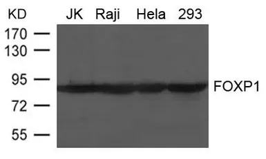 Anti-FOXP1 antibody used in Western Blot (WB). GTX50818
