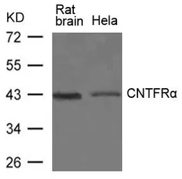 Anti-CNTFR alpha antibody used in Western Blot (WB). GTX50819