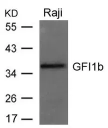 Anti-GFI1b antibody used in Western Blot (WB). GTX50844