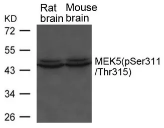 Anti-MEK5 (phospho Ser311/ Thr315) antibody used in Western Blot (WB). GTX50845