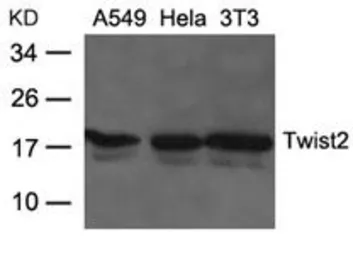Anti-Twist2 antibody used in Western Blot (WB). GTX50850